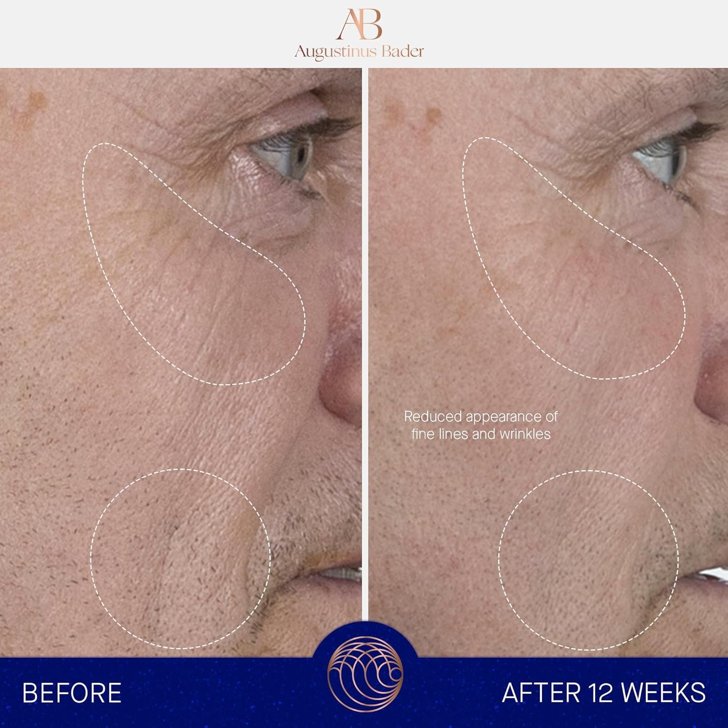 Augustinus Bader The Serum – Luxury Hydrating Anti-Aging Face Serum – Boosts Firmness, Smooths Fine Lines & Evens Skin Tone - Image 3