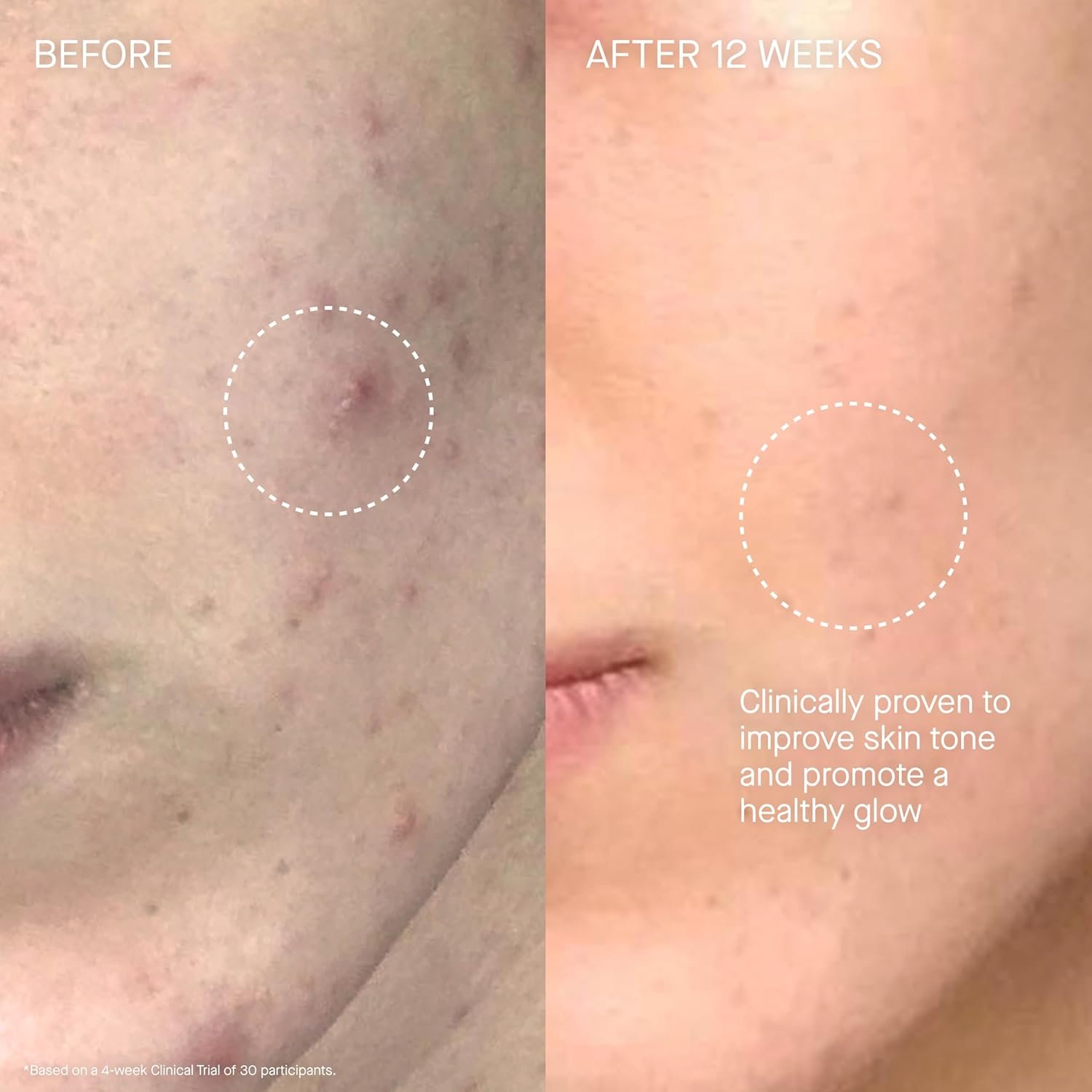 Augustinus Bader The Cream – Luxury Face Cream – Hydrating and Nourishing Face Moisturizer – Facial Moisturizer for Wrinkle Reduction and Cellular Renewal – For Men and Women - Image 5