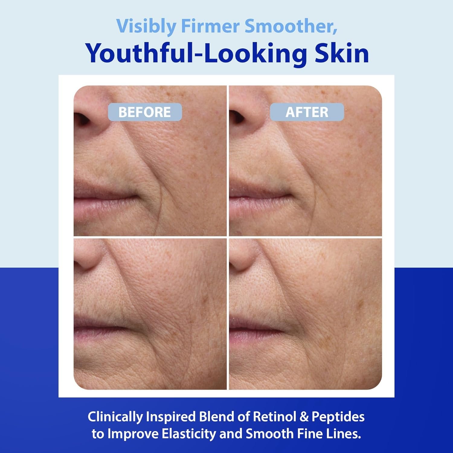 Dr. Denese HydroShield Dream Cream 1.7 oz – Advanced Moisturizer with Ceramides, Retinol and Peptides for Smooth Radiant Skin, Improved Elasticity and Deep Hydration – Doctor Developed, Cruelty Free - Image 6