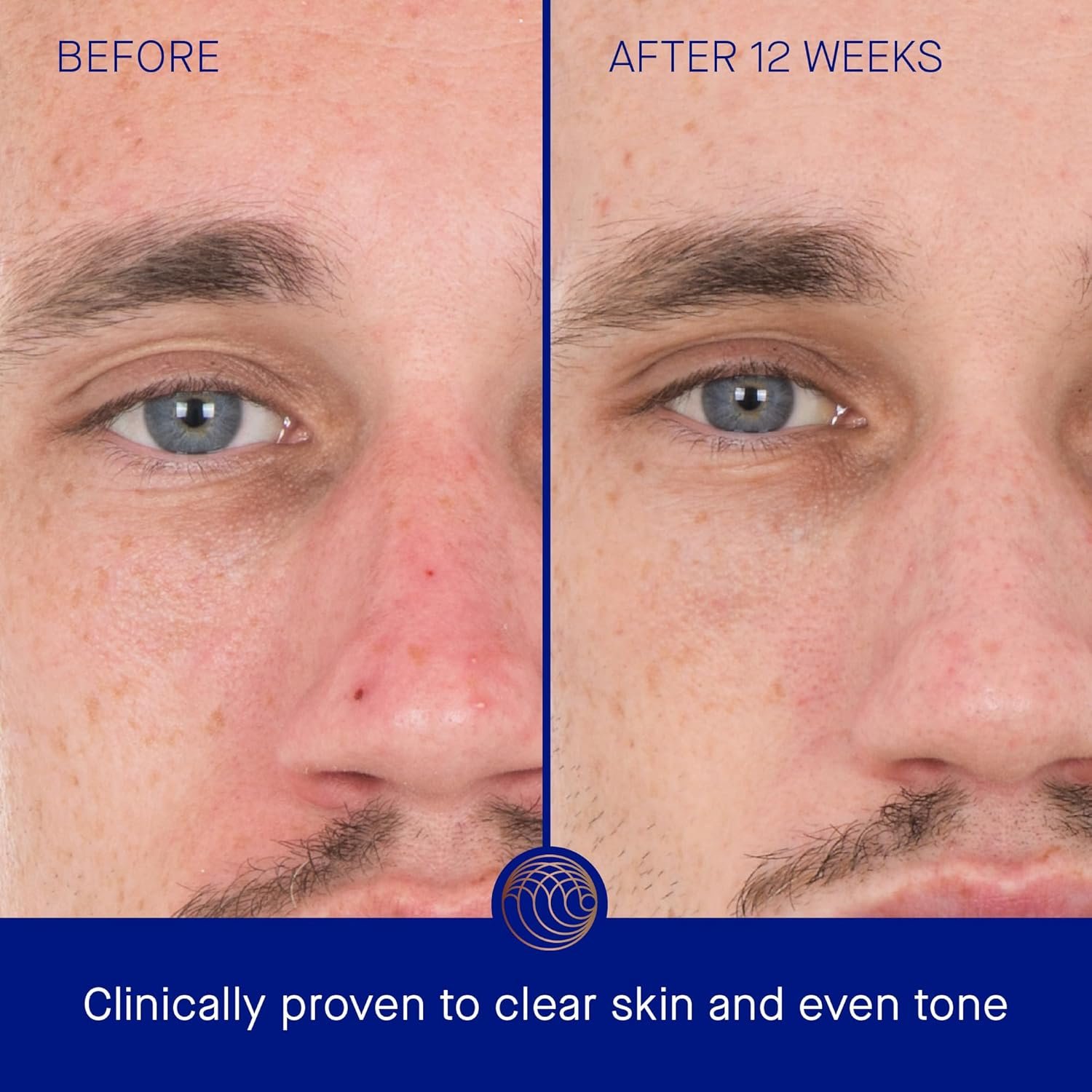 Augustinus Bader The Retinol Serum – Luxury Anti-Aging Face Serum – Smooths Fine Lines, Boosts Firmness & Radiance – Hydrating, Restorative & Skin-Friendly Formula - Image 3